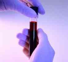 Нормата на билирубин в кръвта