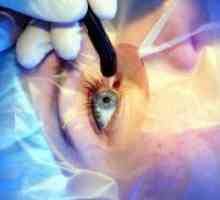 Коригиращи операция на очите
