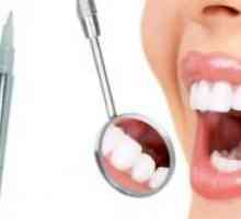Молив избелване на зъбите