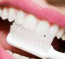 Избелване на зъбите активен въглен