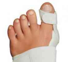 Счупване на палеца на крака