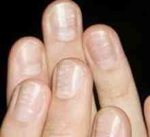 Защо ноктите стават вълнообразни?
