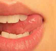 Защо perleches се появяват по устните?