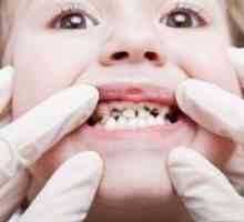 Защо децата стават черни бебешки зъби?