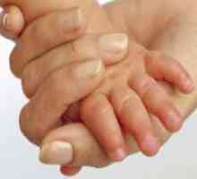 Защо едно дете oblazit кожата на пръстите на ръцете?