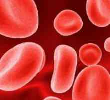 Повишена червените кръвни клетки в кръвта