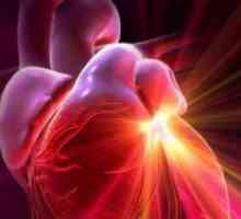 Придобити сърдечни заболявания на сърдечните клапи