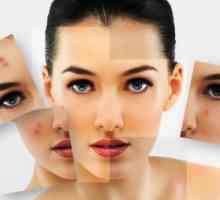 Проблем с кожата: 7 популярни заблуди за акне