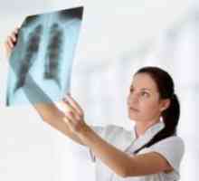 Превенция на туберкулозата