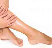 Предотвратяване на разширени вени на краката