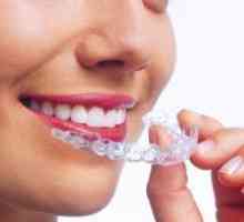 Прозрачен предпазното устройство за уста за привеждане в съответствие на зъби