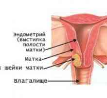 Ракът на маточната шийка - признаци