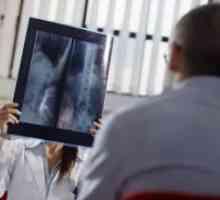 Рентгенови лъчи на стомаха с бариев - Последици
