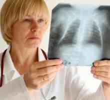 Саркоидоза на белите дробове - симптомите