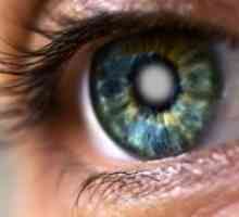 Симптомите на катаракта в ранните етапи