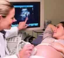 Колко пъти може да направи ултразвук по време на бременност?