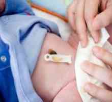 Как е лековита пъпа на новородено?