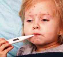 Streptoderma при деца - за третиране на наркотици