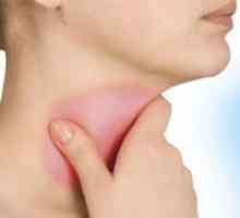 Стрептокок в гърлото
