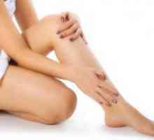 Вени на краката - лечение на народната медицина