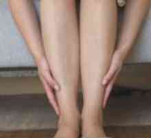Вени на краката - Лечение