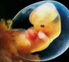 Витрификация на ембриони