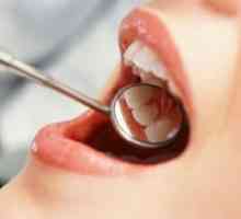 Заболяване на венците - Лечение