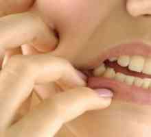 Възпаление на надкостницата на зъба
