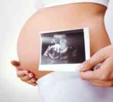 Вреден при ултразвук по време на бременност?