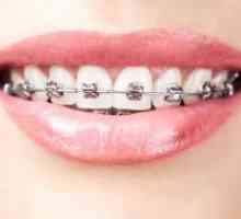 Подреждане на зъбите