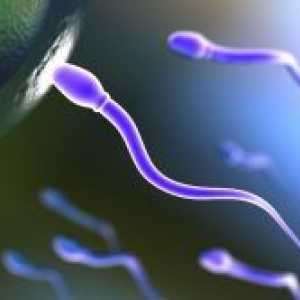 Агрегиране на сперматозоидите