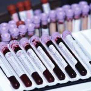 Кръв в онкологията