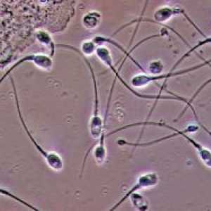 Анализ на сперма