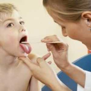 Антибиотици за възпалено гърло при деца