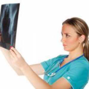 Остеоартроза на тазобедрената - Симптоми