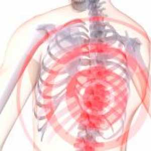 Болка в гръдната кост с остеохондроза