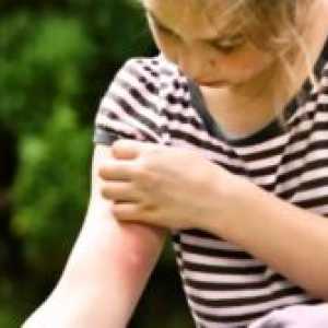 Как за лечение на ухапване от комар дете?