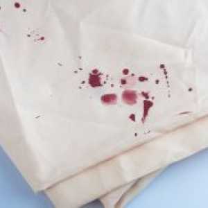Как да се измие кръвта от дрехите си?