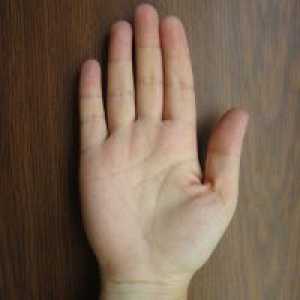 Какво прави един родилен белег на дясната си ръка?
