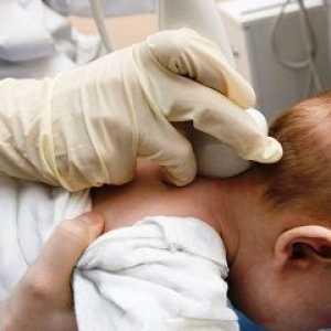 Защо мозъка ултразвук бебе