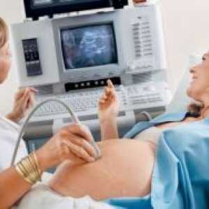 Доплер по време на бременност - какво е това?
