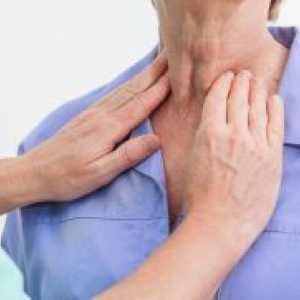 Фоликуларен рак на щитовидната жлеза