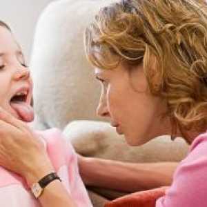 Херпес болки в гърлото при деца - Лечение
