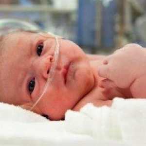 Хипоксия при новородени - какво е това?