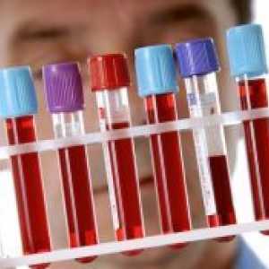 Тест ензимен имуноанализ кръв