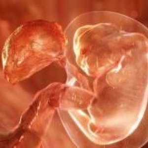 Имплантирането на ембриона - признаци