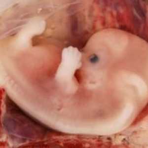 Човешки ембрион