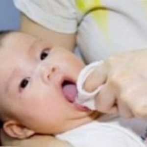 Как за лечение на гъбична инфекция при новородени?