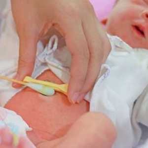 Как да се справят с пъпа на новороденото