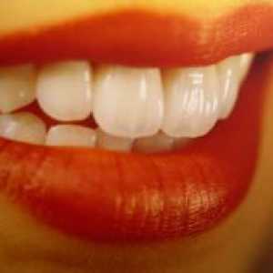 Какво корони на зъбите по-добре?